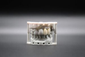 Partial denture sample2