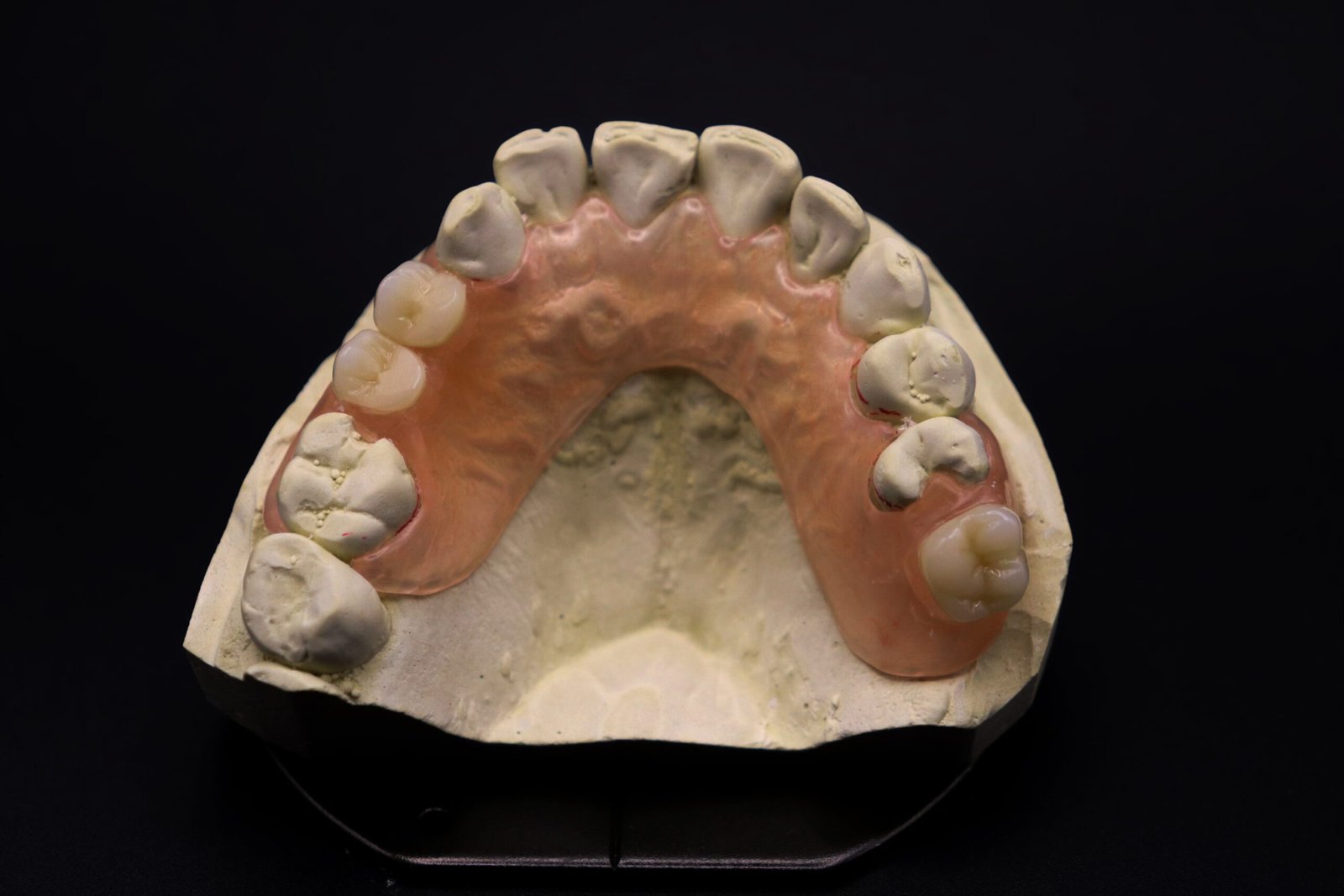 Partial denture sample