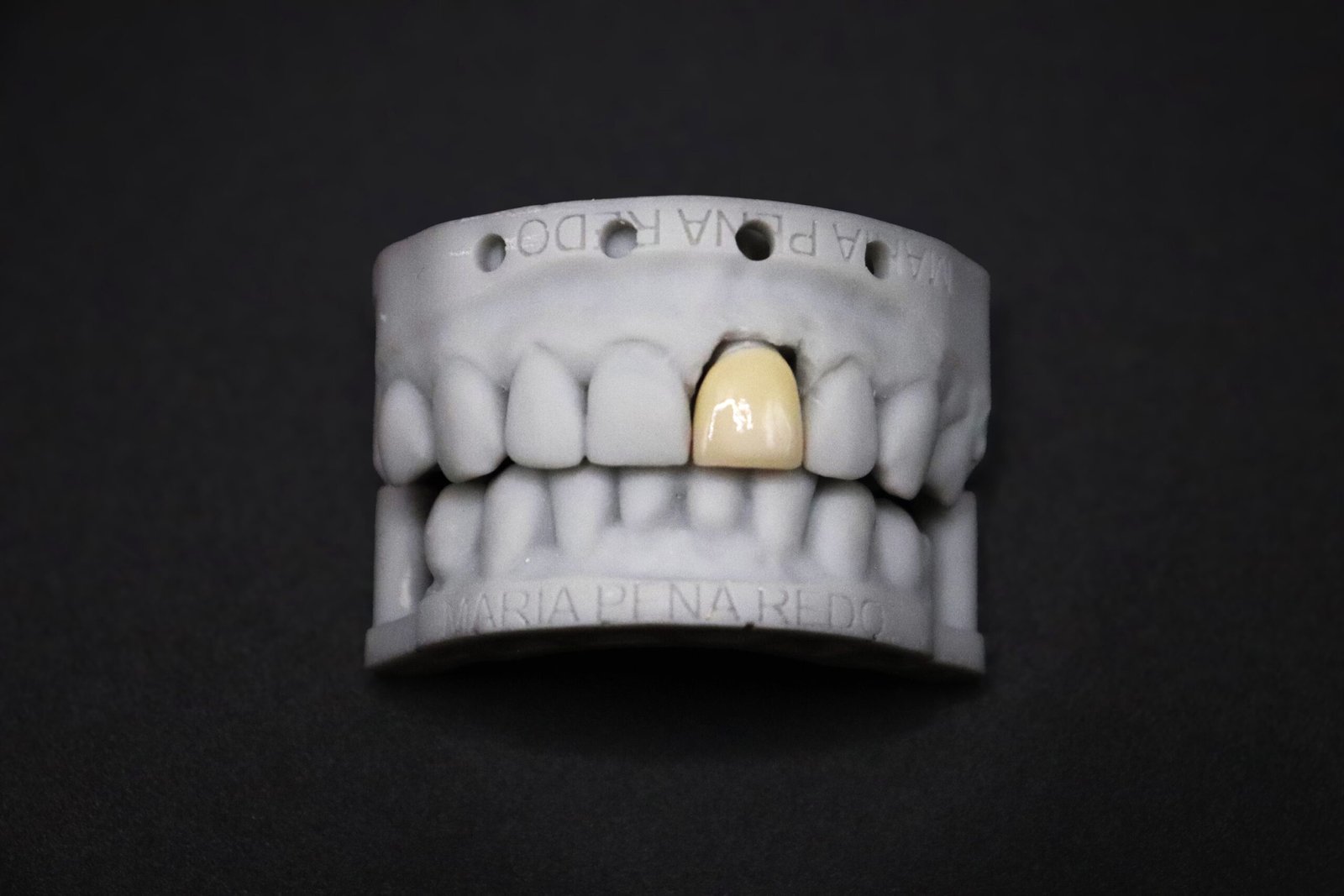 Implant restoration